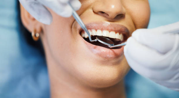 Best Emergency Treatment for Dental Infections or Abscesses in Elkhorn, WI